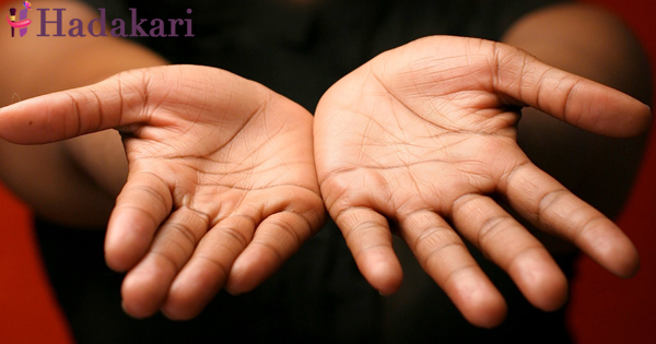 ඔයා නිරෝගිද කියලා හරියටම දැන ගන්න අත් දෙකෙන් සාත්තරයක් බලමුද? | What to say by looking at your hand