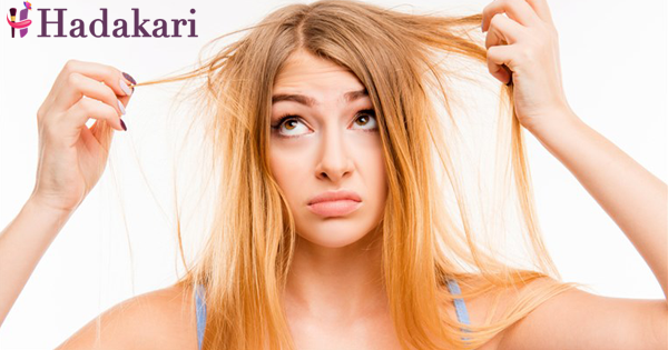 හිසකෙස් කැඩී යනවද? කෙස් අග පලුදු වෙලාද? හිස කෙස් වියළිලාද? මෙන්න නියම විසඳුමක් | Here is the answer for hair problems