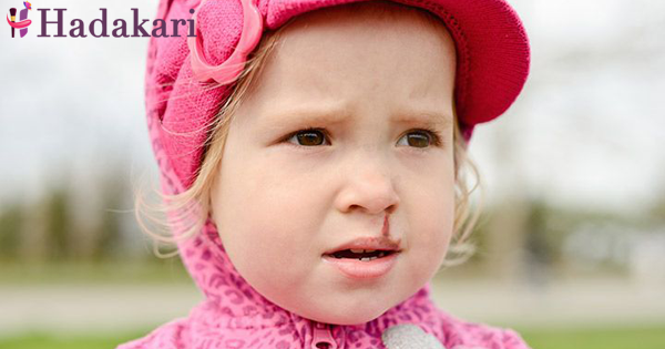 දඟකාර පොඩ්ඩාගේ නාසය තුළින් රුධිර ගැලීමකදී කළ යුත්තේ කුමක්ද? | What you should do if your child’s nose is bleeding