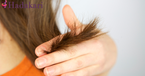 හිසකෙස් අග පැලීම නිසා ඔබත් ආතතියට පත්වෙලාද..එසේනම් මේ පහසු ක්‍රම 6 අත් හදා බලන්න. | Save your hair from split ends