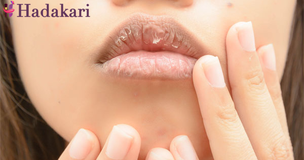 tooth paste වලින් දෙතොලට සත්කාර. දෙතොල් අවපැහැ වුණු අයට විශේෂයි | Lip treatments with toothpaste