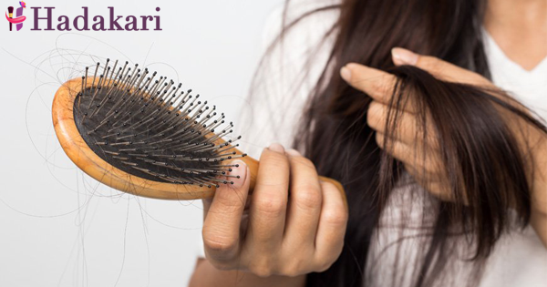 හිස්සොරි නිසා හිසකෙස් ගැලවී යාම වලක්වා ගන්නේ කෙසේද? | How to avoid hair loss from dandruff